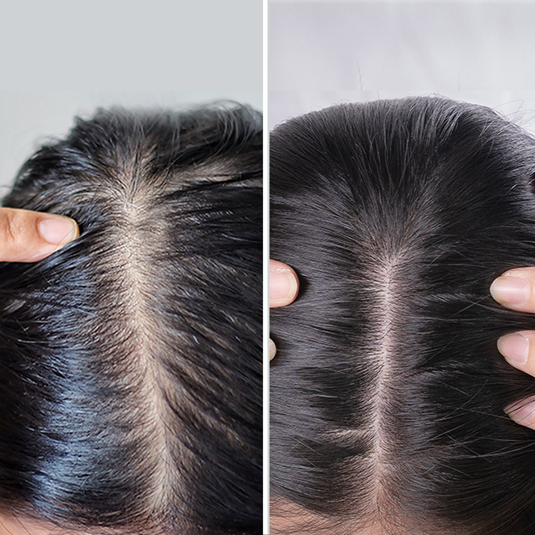 Oily Scalp Regime | Set of 3 - 600ml - Hair Care Bundle