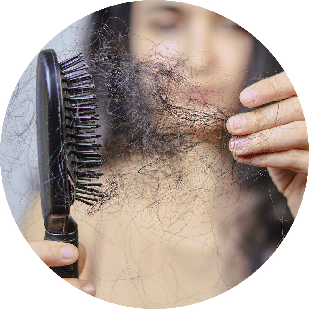 Postpartum Hair Loss