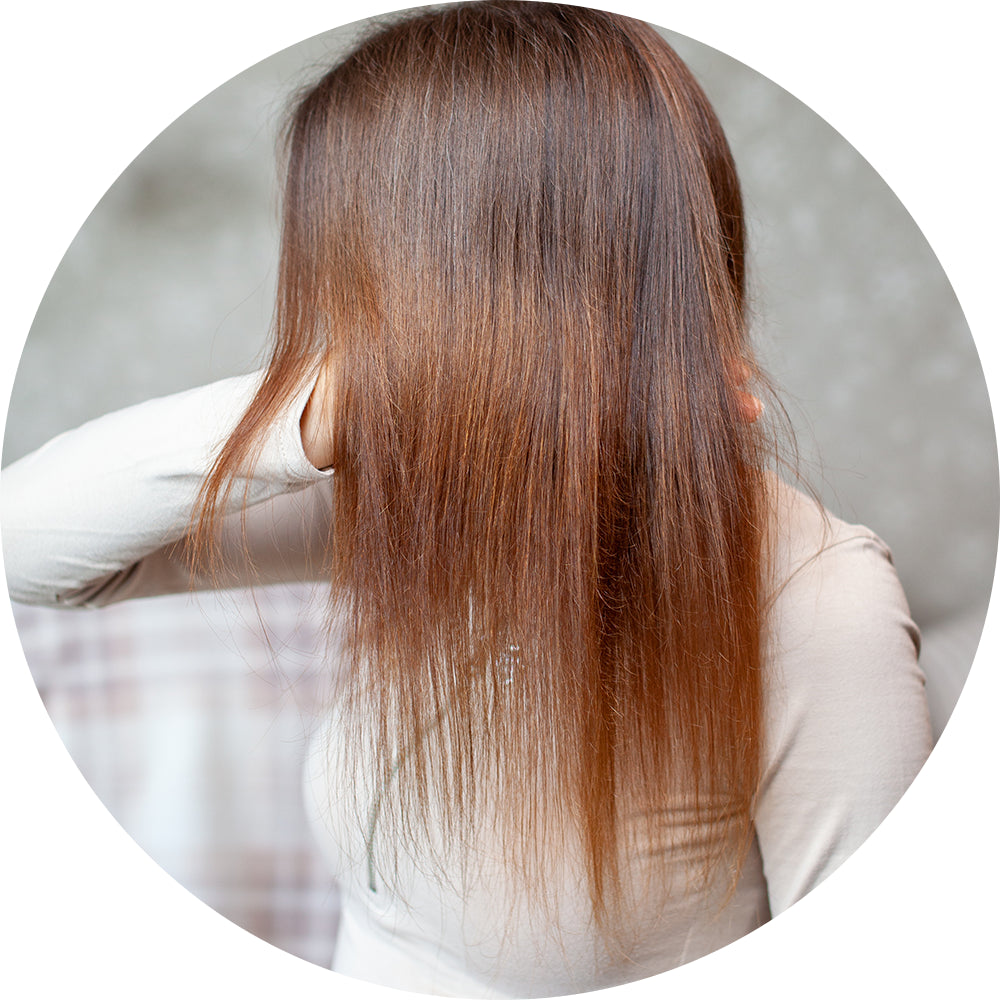 Hair Thinning