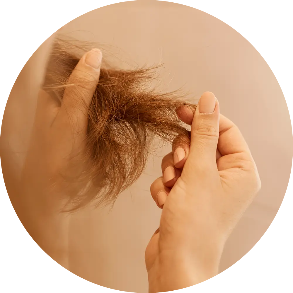 Damage-Prone Hair